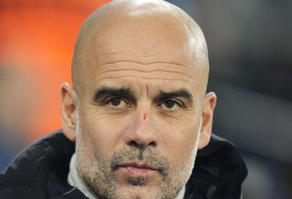 Guardiola otkrio šta se krije iza ogrebotina na glavi: "Tri godine sam na lijekovima" Guardiola otkrio šta se krije iza ogrebotina na glavi: "Tri godine sam na lijekovima"