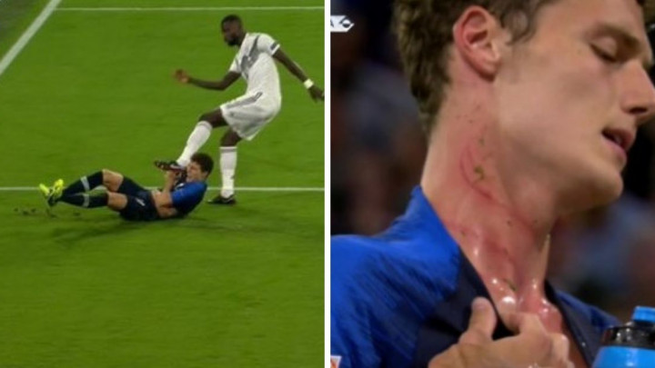 Rudiger prošao nekažnjeno nakon brutalnog gaženja Pavarda