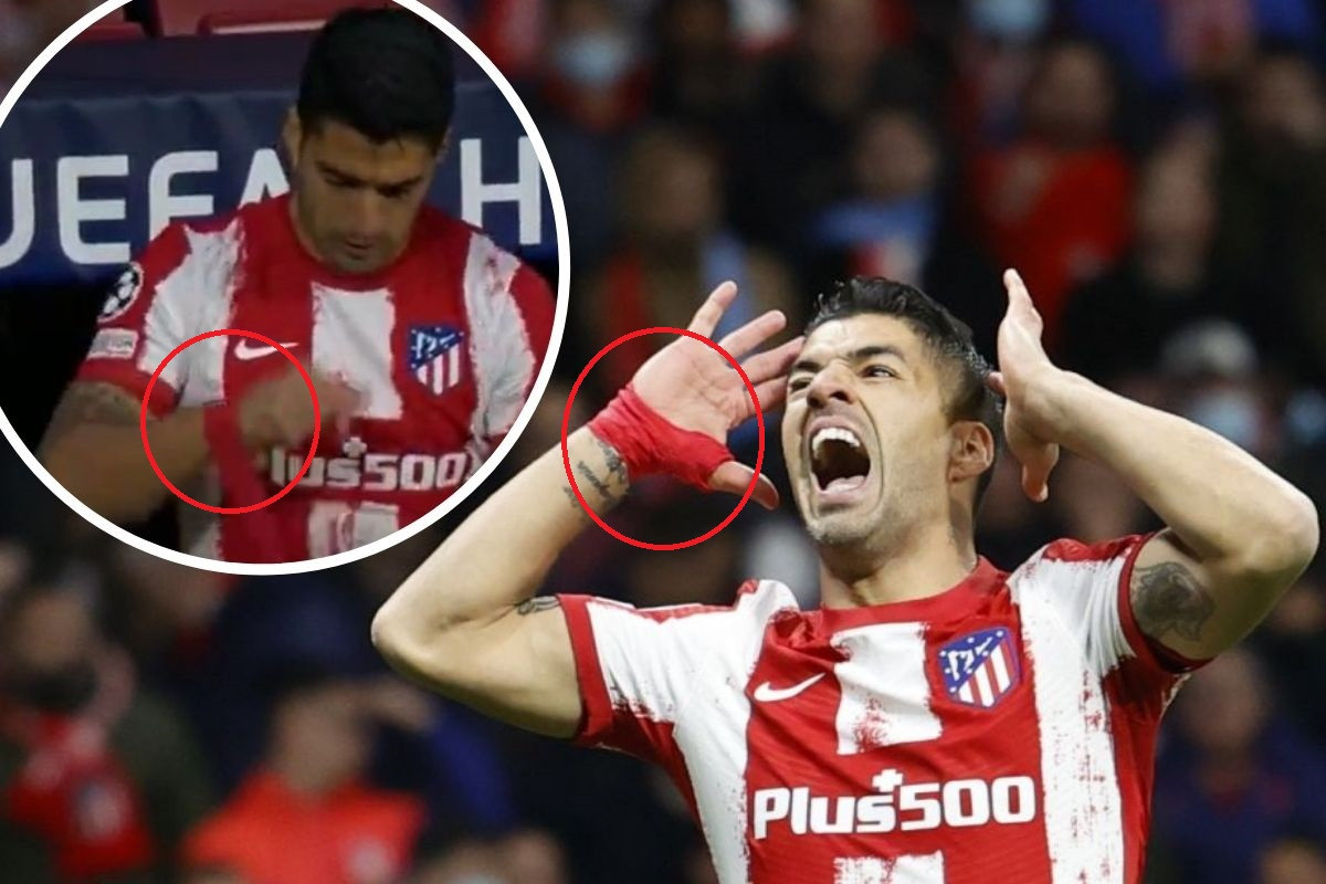 Sinoć konačno riješena misterija zašto Luis Suarez nosi zavoj na desnoj ruci
