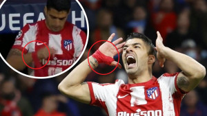 Sinoć konačno riješena misterija zašto Luis Suarez nosi zavoj na desnoj ruci