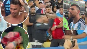 Trijumf Argentine u Riju, ali i haos - Policija tuče navijače, jedan krvav leži, Messi u nevjerici!