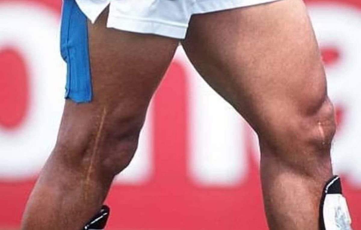 Strašnija i od Ronaldovih: Čuvena koljena puna ožiljaka kao jeziva uspomena na veliku karijeru Strašnija i od Ronaldovih: Čuvena koljena puna ožiljaka kao jeziva uspomena na veliku karijeru
