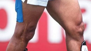 Strašnija i od Ronaldovih: Čuvena koljena puna ožiljaka kao jeziva uspomena na veliku karijeru