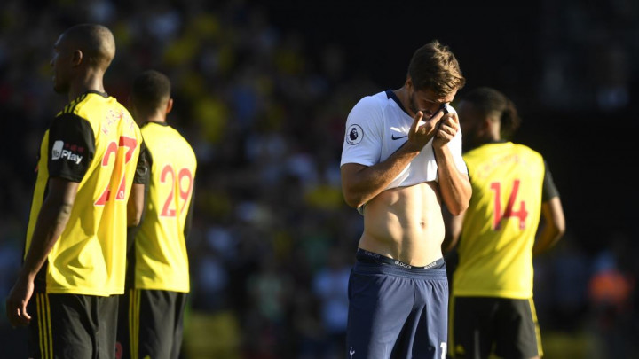 Problemi za Tottenham: Vertonghen pauzira do decembra