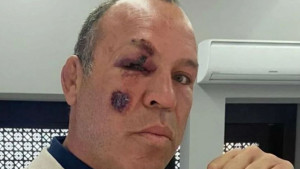 Legendarnog MMA borca udario automobil dok je vozio bicikl: "Mogao sam poginuti"