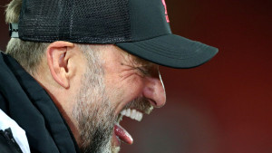 Klopp nije prepoznao bivšu zvijezdu Manchester Cityja: "Jesi li ti ikada igrao?"