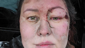 Ukrajinska trenerica preživjela granatiranje Harkova: Mislila sam da ću umrijeti živa zakopana