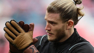 Karius protiv Manchestera branio u posebnim rukavicama, takve imaju samo tri osobe na svijetu