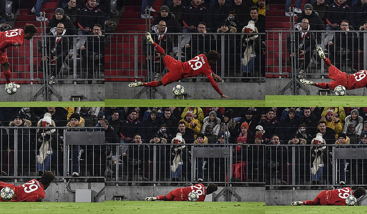 Povreda koju u Bayernu niko nije želio vidjeti Povreda koju u Bayernu niko nije želio vidjeti