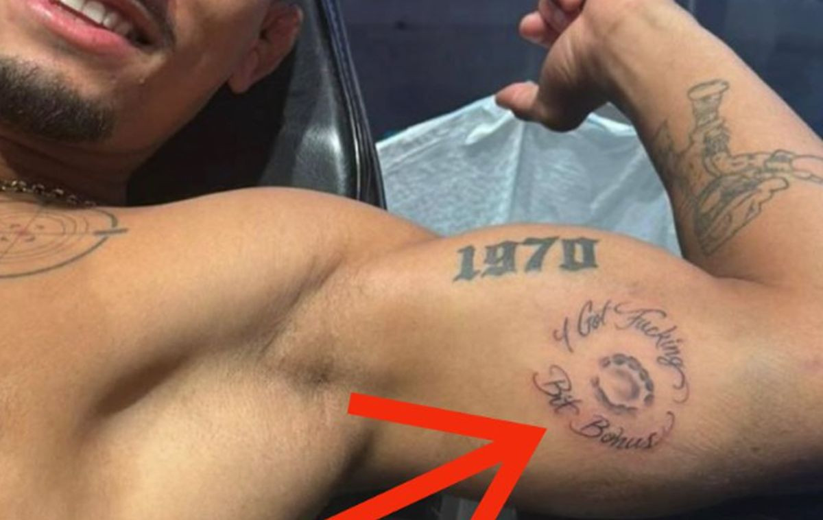 Brazilac zauvijek izbačen jer je ugrizao protivnika koji je na istom mjestu napravio ludu tetovažu