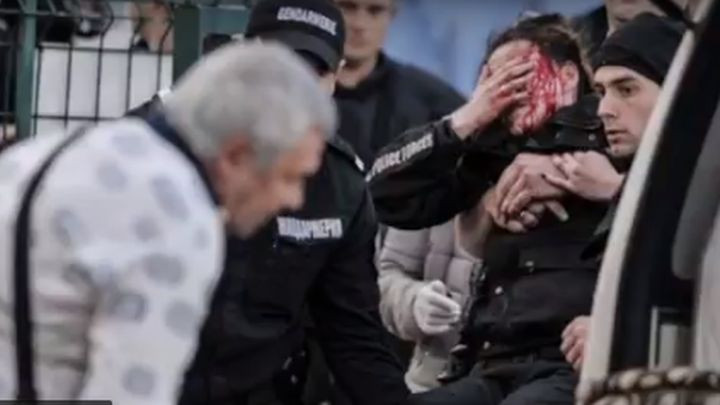 Huliganima nije mjesto na sportskim terenima: Policajka umalo ostala bez oka 