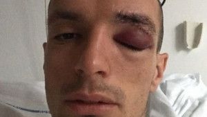 Jasmin Mešanović uspješno operisan u Mariboru