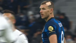 Džeko igra sa 'uspomenom' iz derbija