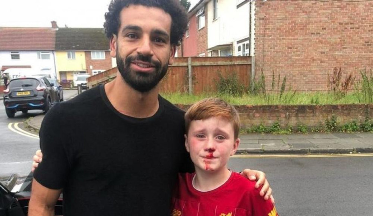 Dječak razbio nos, Salah se potrudio da mu ovo bude jedan od najljepših dana u životu