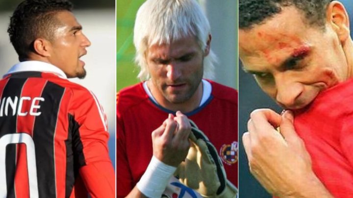 TOP 10 najbizarnijih i najsmješnijih povreda u fudbalu