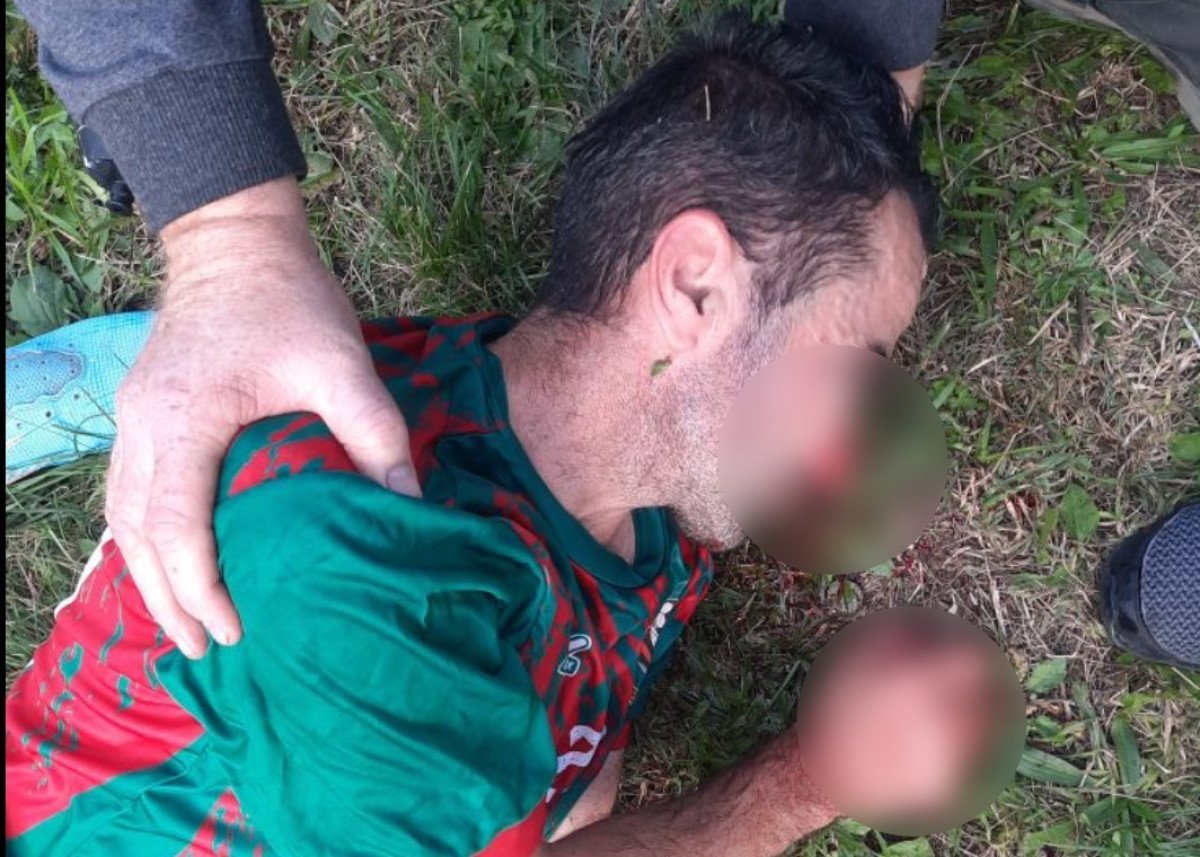Haos na terenu u TK: Igrač krvav završio na UKC, iz drugog kluba tvrde da su ih ganjali satarom!