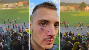 Divljačke scene u Prvoj ligi FBiH: Fudbaler Stupčanice zvjerski pretučen pred stotinama prisutnih!