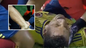 Njegovi krici odjekivali stadionom: Pogledajte kako izgleda Ariasova noga nakon stravičnog loma