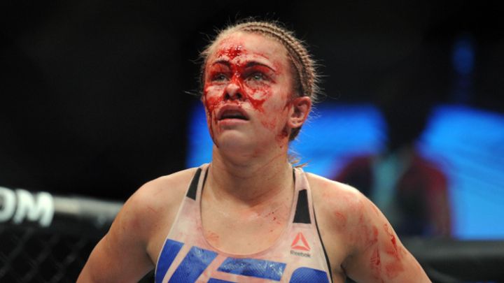 UFC ljepotica pokazala lice poslije batina