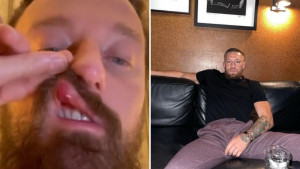 McGregor napravio novi skandal: Conor u Rimu pretukao italijanskog pjevača