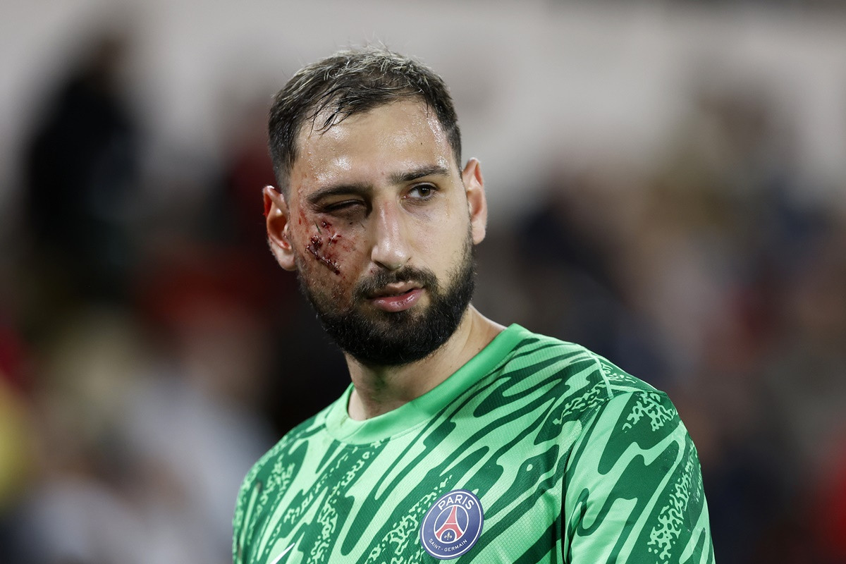 Gianluigi Donnarumma ima 10 šavova, poznato je šta ga čeka u narednom periodu Gianluigi Donnarumma ima 10 šavova, poznato je šta ga čeka u narednom periodu
