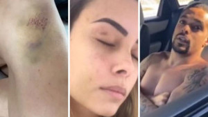 Pojavio se novi nasilnik među fudbalerima: Unakažena supruga je sve javno objavila!