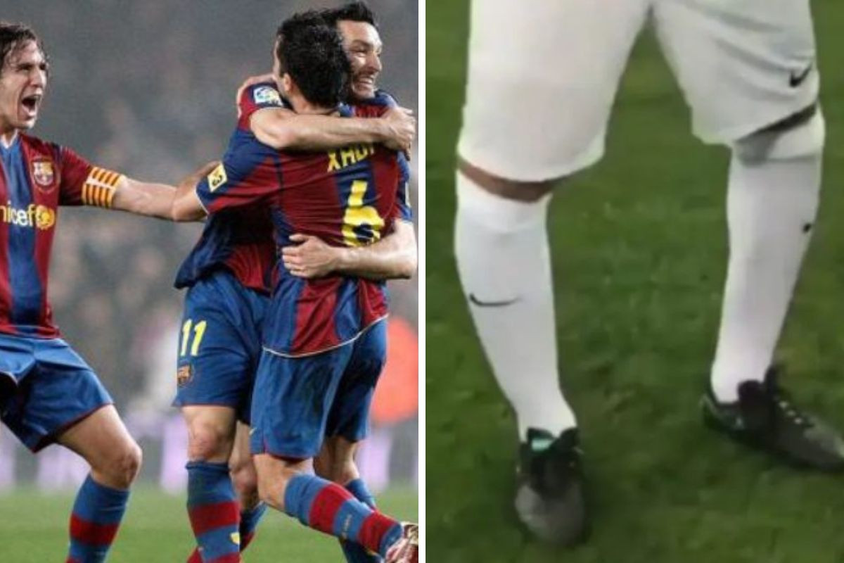 Bivša zvijezda Barce o iskrivljenim nogama: "Ispravit će ih tako što će izrezati komadiće kosti" Bivša zvijezda Barce o iskrivljenim nogama: "Ispravit će ih tako što će izrezati komadiće kosti"