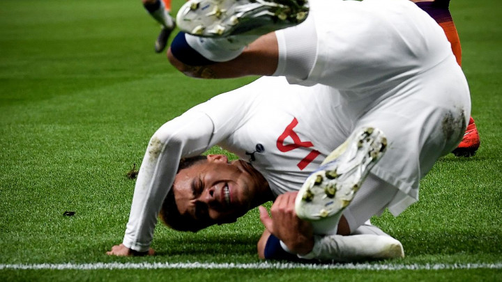 Dele Alli će u revanšu protiv Cityja vjerovatno igrati sa slomljenom rukom