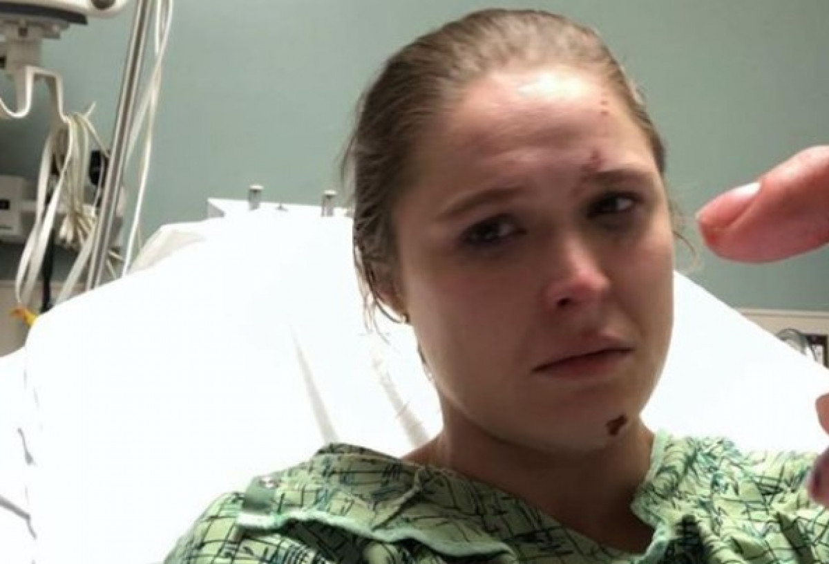 Ronda Rousey doživjela stravičnu povredu na snimanju serije