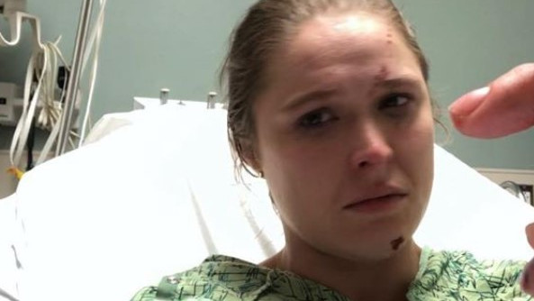 Ronda Rousey doživjela stravičnu povredu na snimanju serije