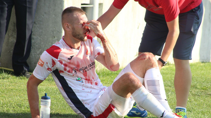 Užasne scene iz Doboja kod Kaknja: Hasić obliven krvlju odvezen u bolnicu