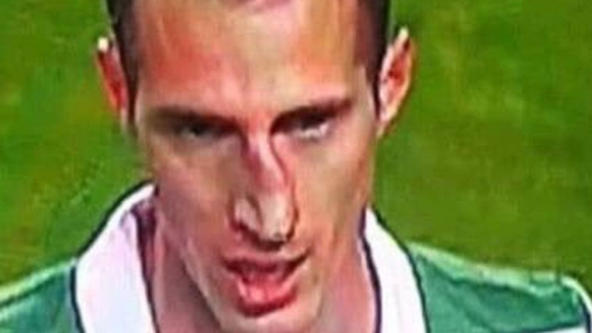 Defanzivac Sportinga slomio nos i izašao iz igre, igrač koji ga je zamijenio također slomio nos 