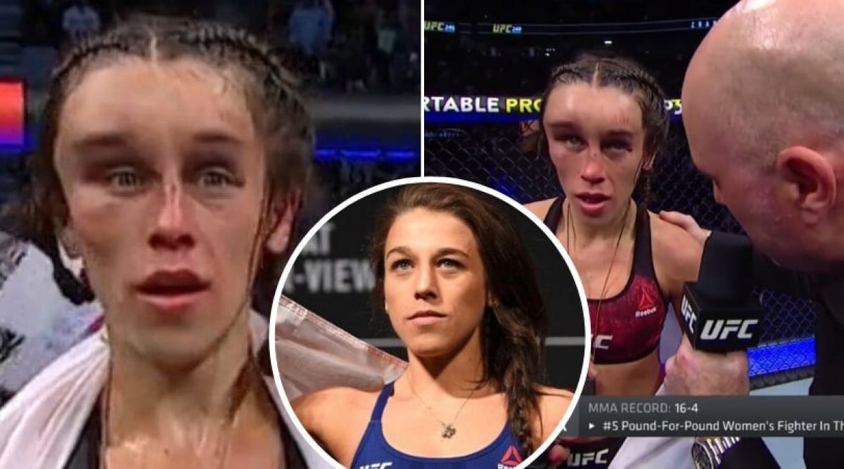 Ljekari se šokirali kada su vidjeli kako izgleda Joanna Jedrzejczyk nakon UFC borbe
