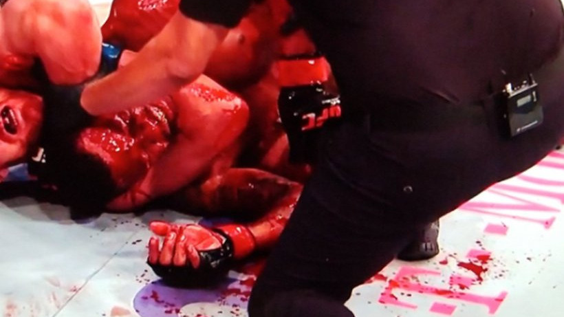 UFC ne pamti krvaviju borbu