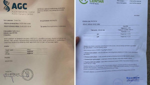 Imamo i nalaze: Zec "davno" prebolovao koronu, pa opet dva puta negativan nakon pozitivnog nalaza