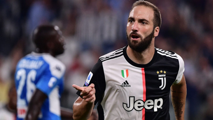 Higuain propušta derbi