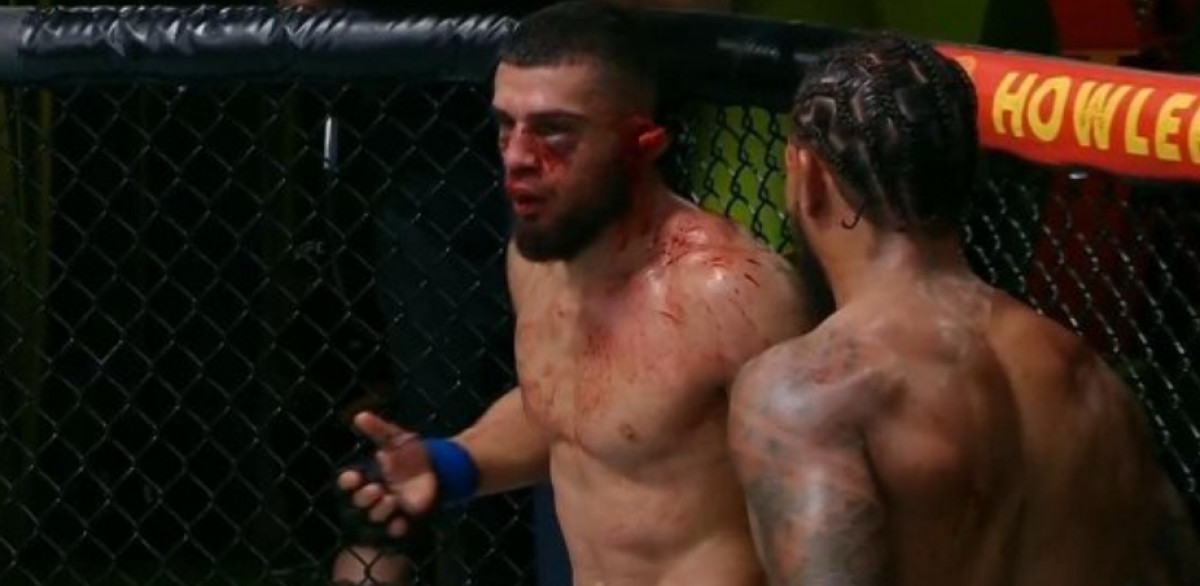 Nije za one sa slabim želucem: Svijet priča o stravičnoj povredi UFC borca