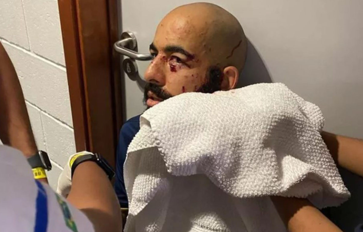 Bombaški napad na autobus ekipe koja je nedavno ispala iz lige, najgore prošao golman Bombaški napad na autobus ekipe koja je nedavno ispala iz lige, najgore prošao golman