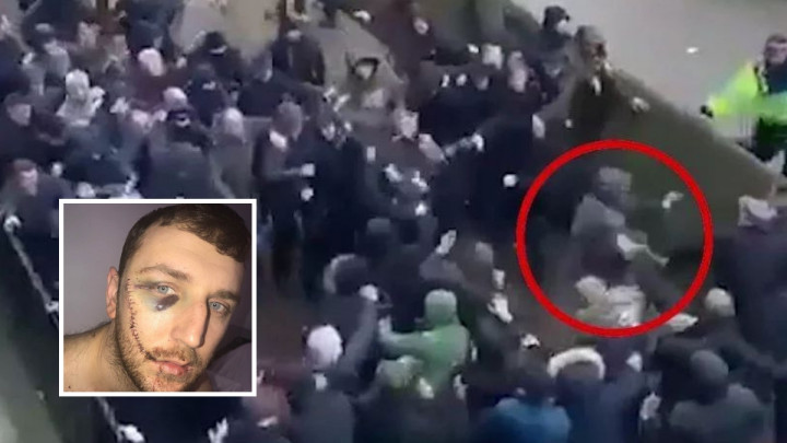 Oglasio se navijač koji je dobio nož u lice: "Više se ne mogu pogledati u ogledalo"