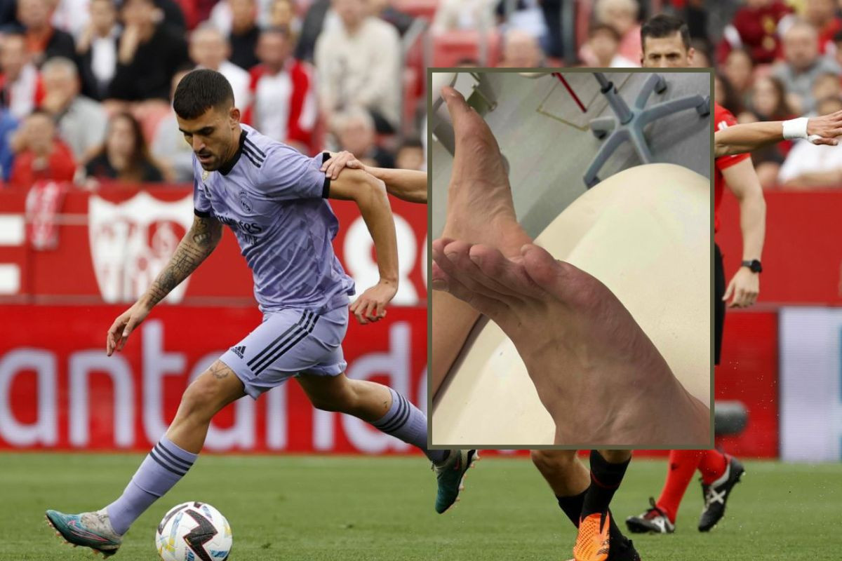 Fudbaler Reala je junak vikenda: Fotografija njegove noge dovoljno govori