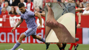 Fudbaler Reala je junak vikenda: Fotografija njegove noge dovoljno govori