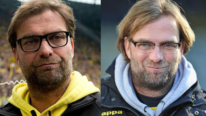 "Klopp je tada trebao ići na presađivanje kose, a onda mi je rekao nešto vrlo zbunjujuće"
