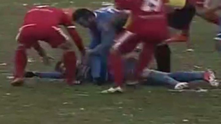 Drama u Bijeljini nakon žestokog udarca laktom