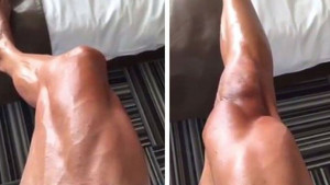 Kao da mu noga ima vlastiti život: Nevjerovatan snimak mišića španskog bicikliste 