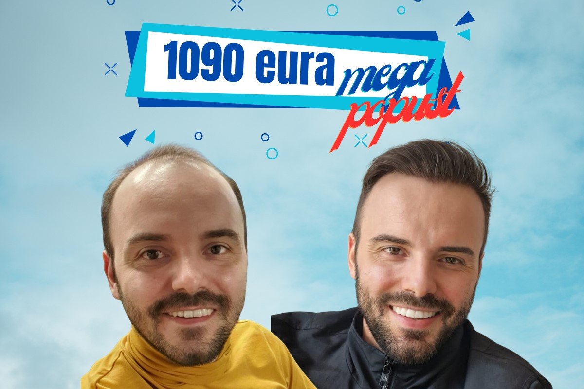 Transplantacija kose u klinici VatanMed u Sarajevu - Do 15. juna neponovljivi popust Transplantacija kose u klinici VatanMed u Sarajevu - Do 15. juna neponovljivi popust
