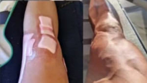'Zvijer' je sazidana od mišića: Niko ne može ni naslutiti da je nedavno izvršena teška operacija
