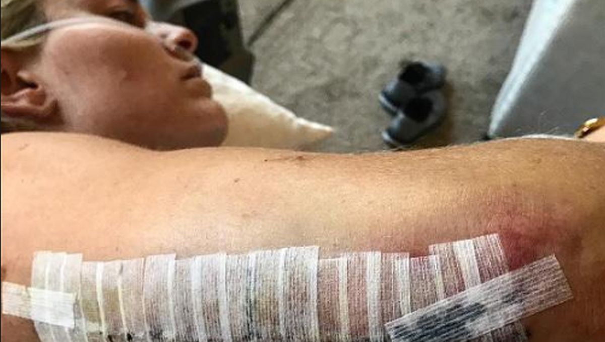 Nije sve idealno kada ste bogati i slavni: Horor povrede poznatih sportista 