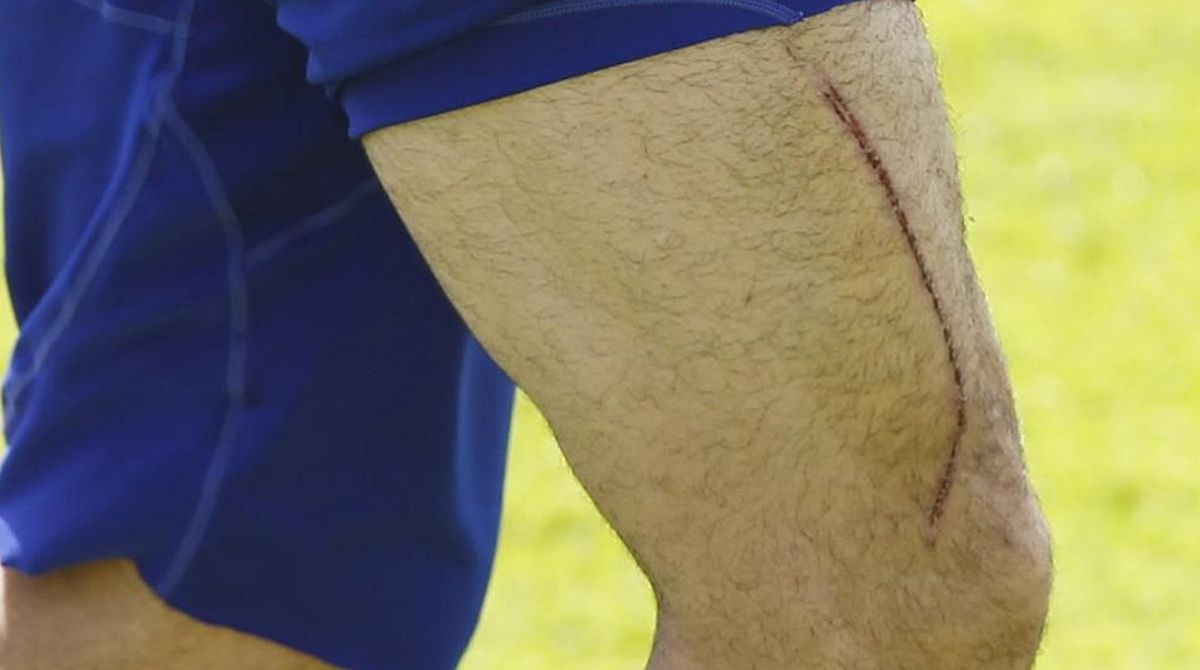 Nije sve idealno kada ste bogati i slavni: Horor povrede poznatih sportista 