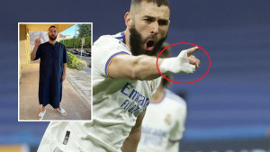 Benzema uvijek igra s bandažom, konačno je pokazao kako mu izgleda mali prst desne ruke