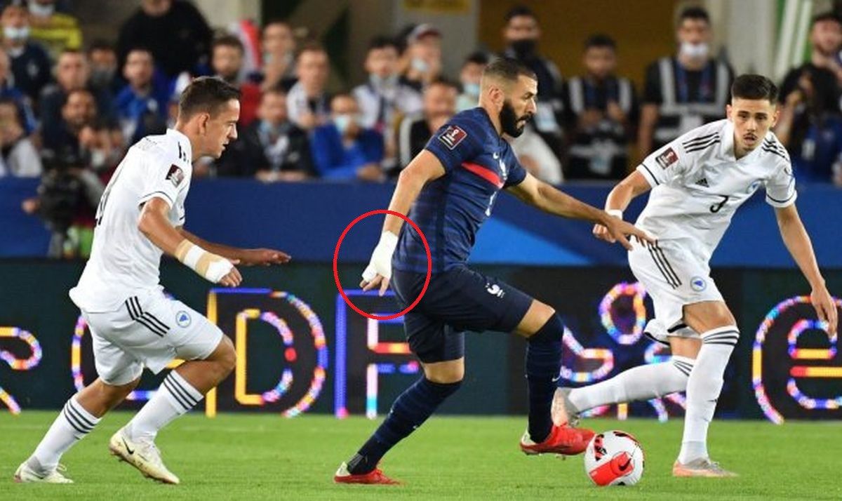 Francuz uvijek igra s bandažom: Fotografi su uspjeli Benzeminu "uhvatiti" ruku bez zavoja
